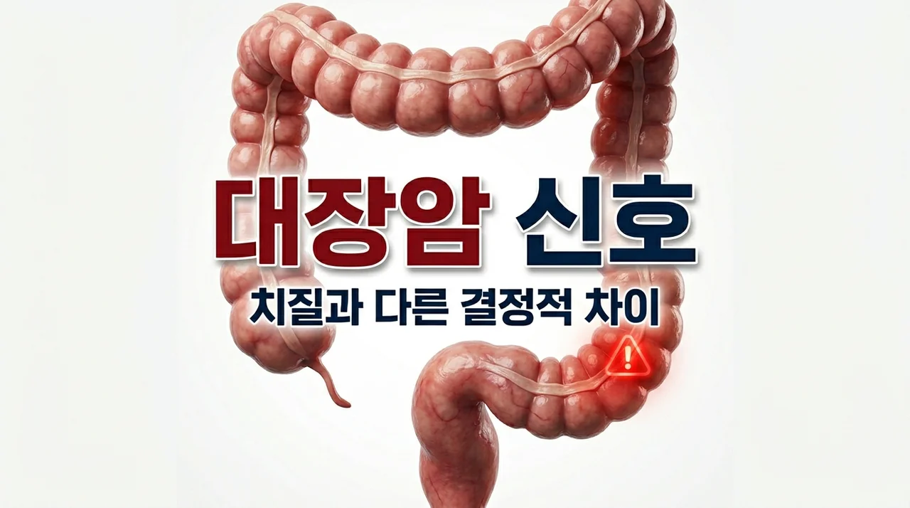 치질인 줄 알았는데... 대장암이 보내는 의외의 초기 증상 신호 5가지