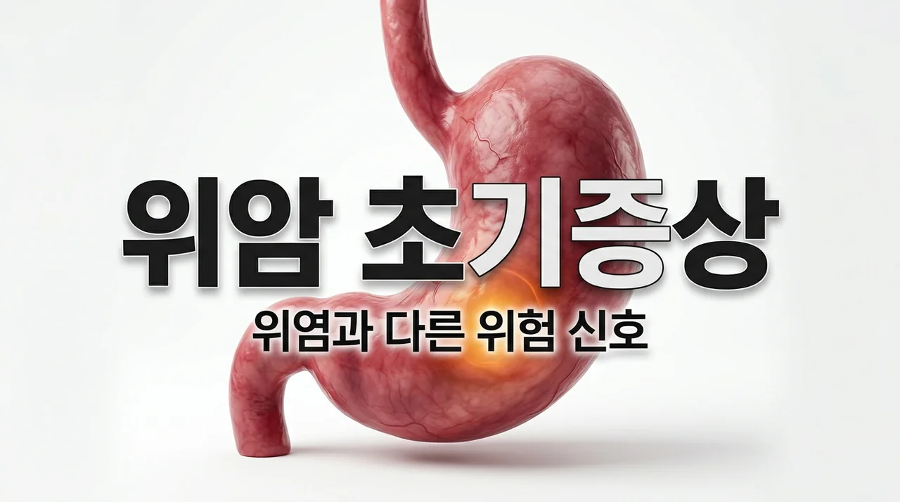 위암 증상 초기 신호 5가지, 단순 위염으로 방치하면 안 되는 이유