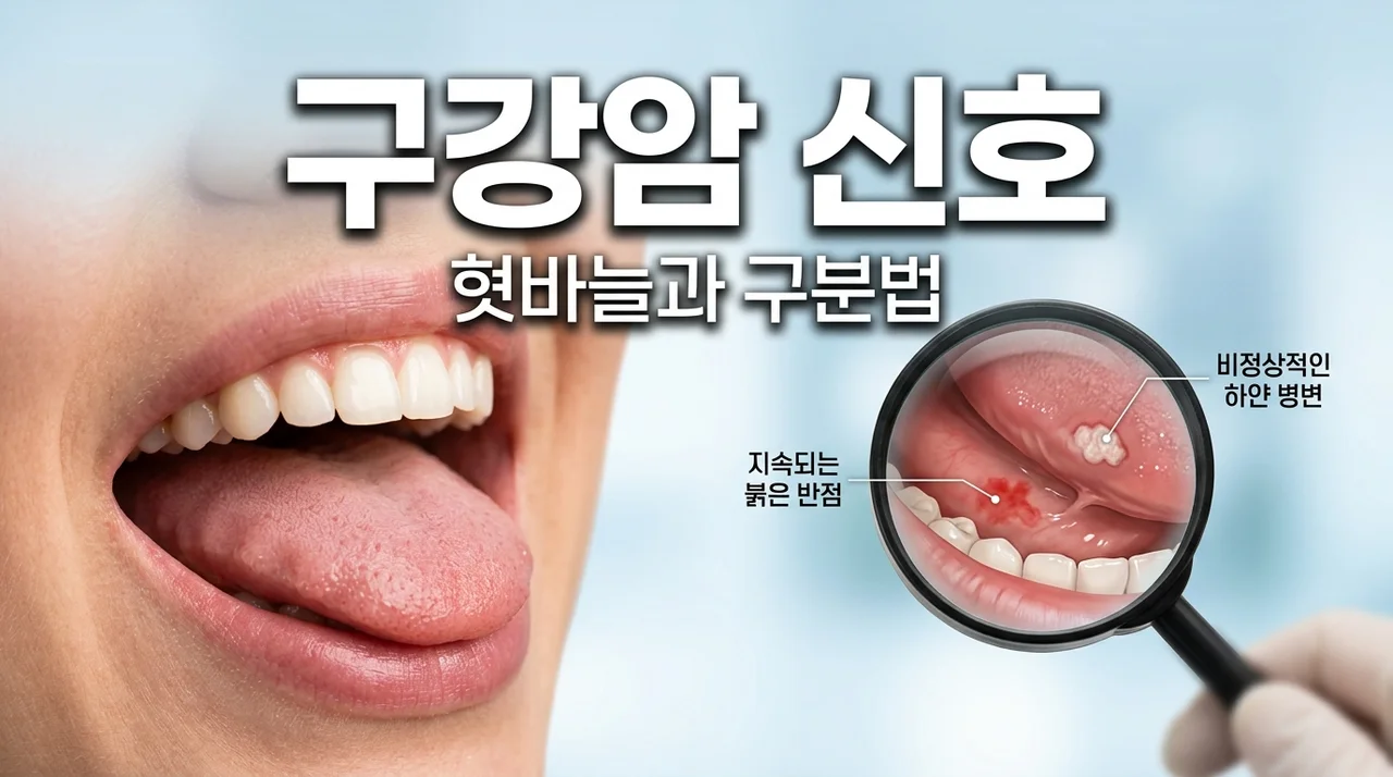 구강암 초기증상 혓바늘로 착각하기 쉬운 5가지 경고 신호