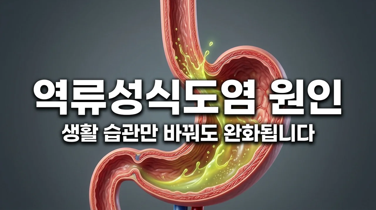 역류성식도염 원인 5가지와 당장 고쳐야 할 나쁜 습관 총정리